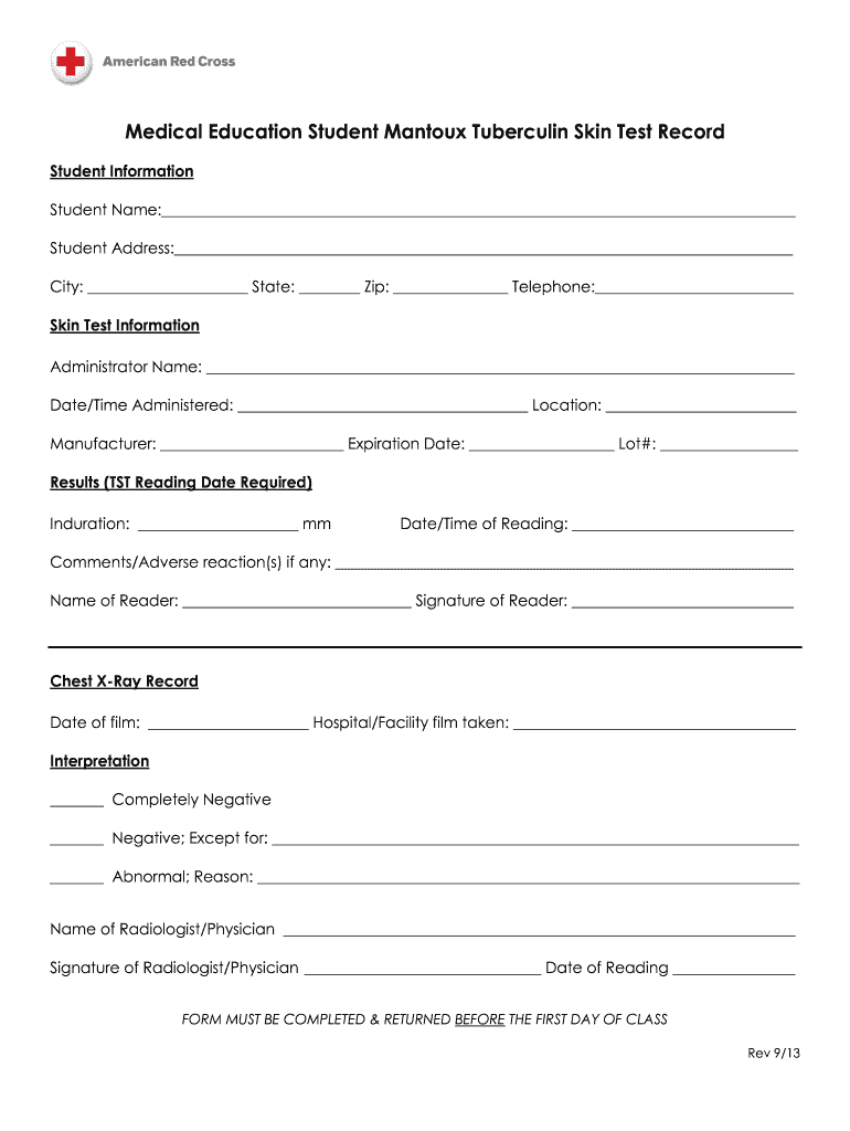 free printable tb skin test form